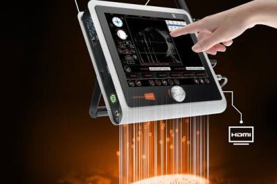 Ultrassonografia ALTA RESOLUÇÃO